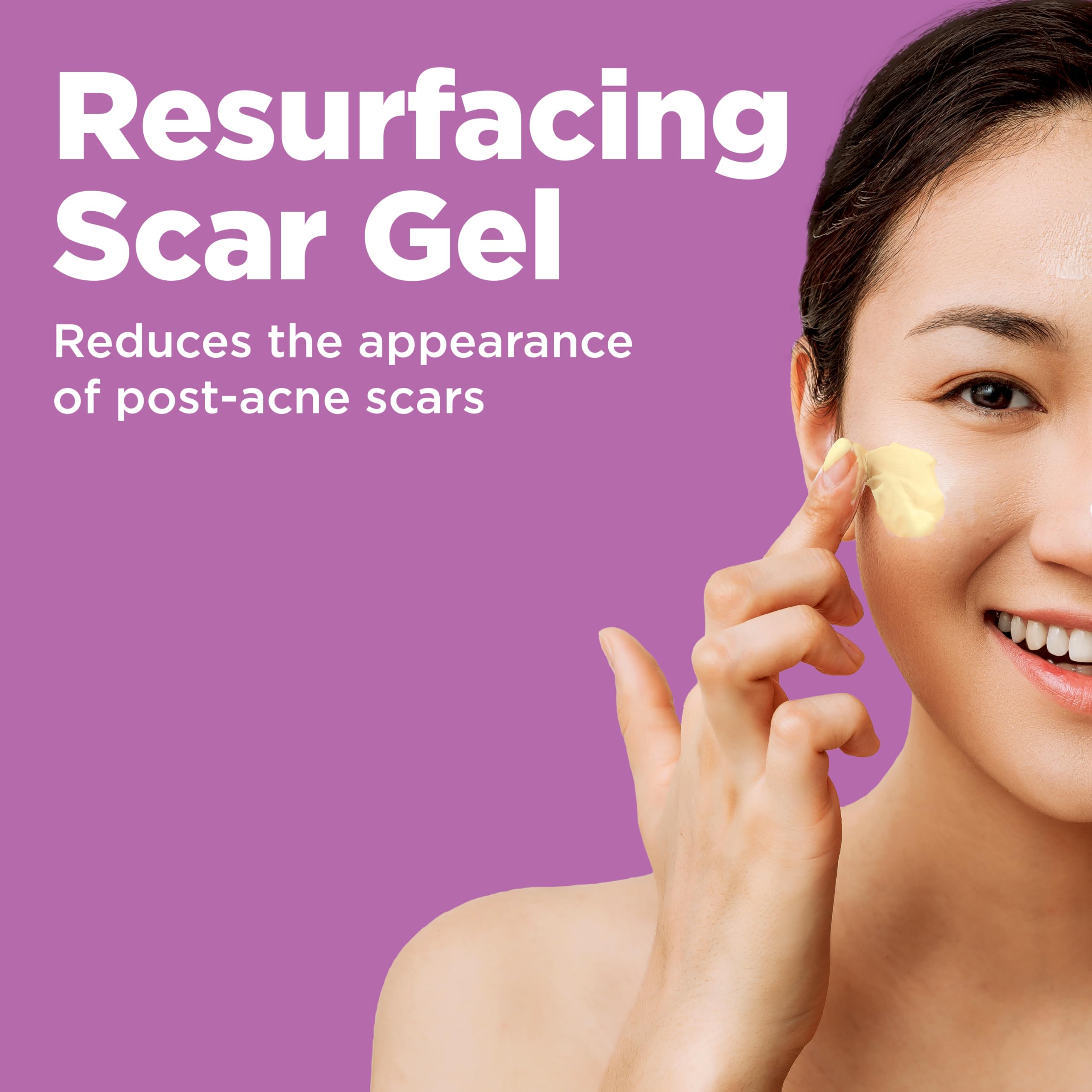 Differin Resurfacing Scar Gel - 1oz $12.49 at Amazon and Walgreens